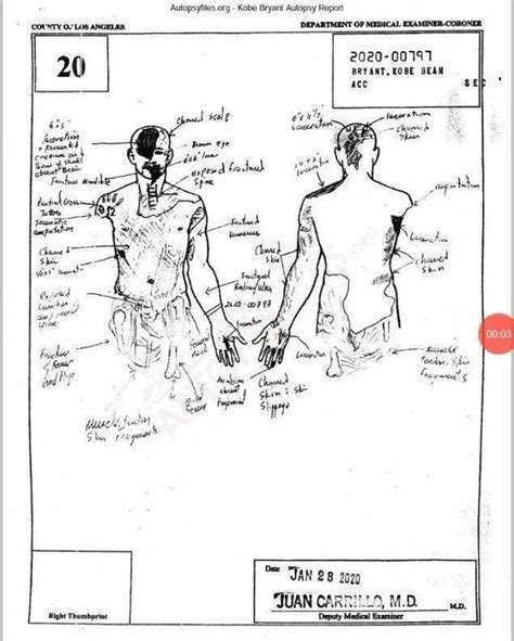 kobe bryant body sketch|Kobe Bryant Autopsy Report Is Released After。